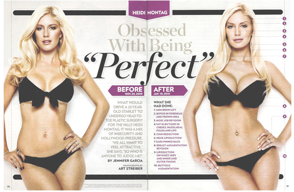 heidi montag after surgery pics. This makes me weep.